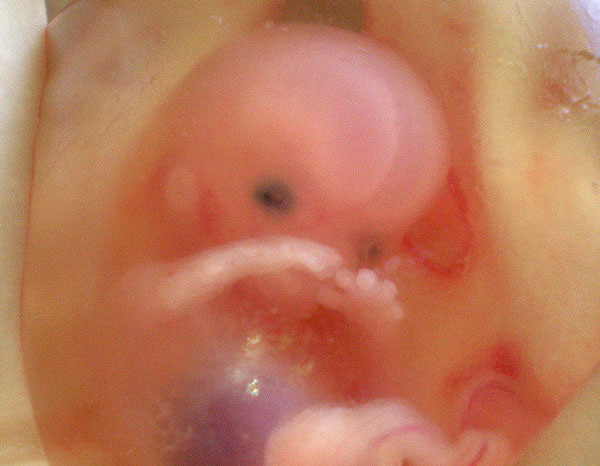 regain Memo page Bebelusul in sacul amniotic - Bebee.ro